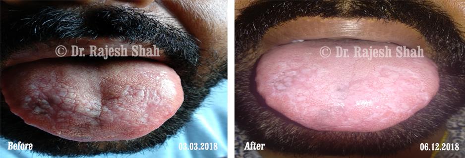 lifeforce homeopathy case-photos